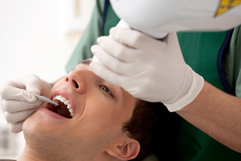 Dental Fillings in Sundance